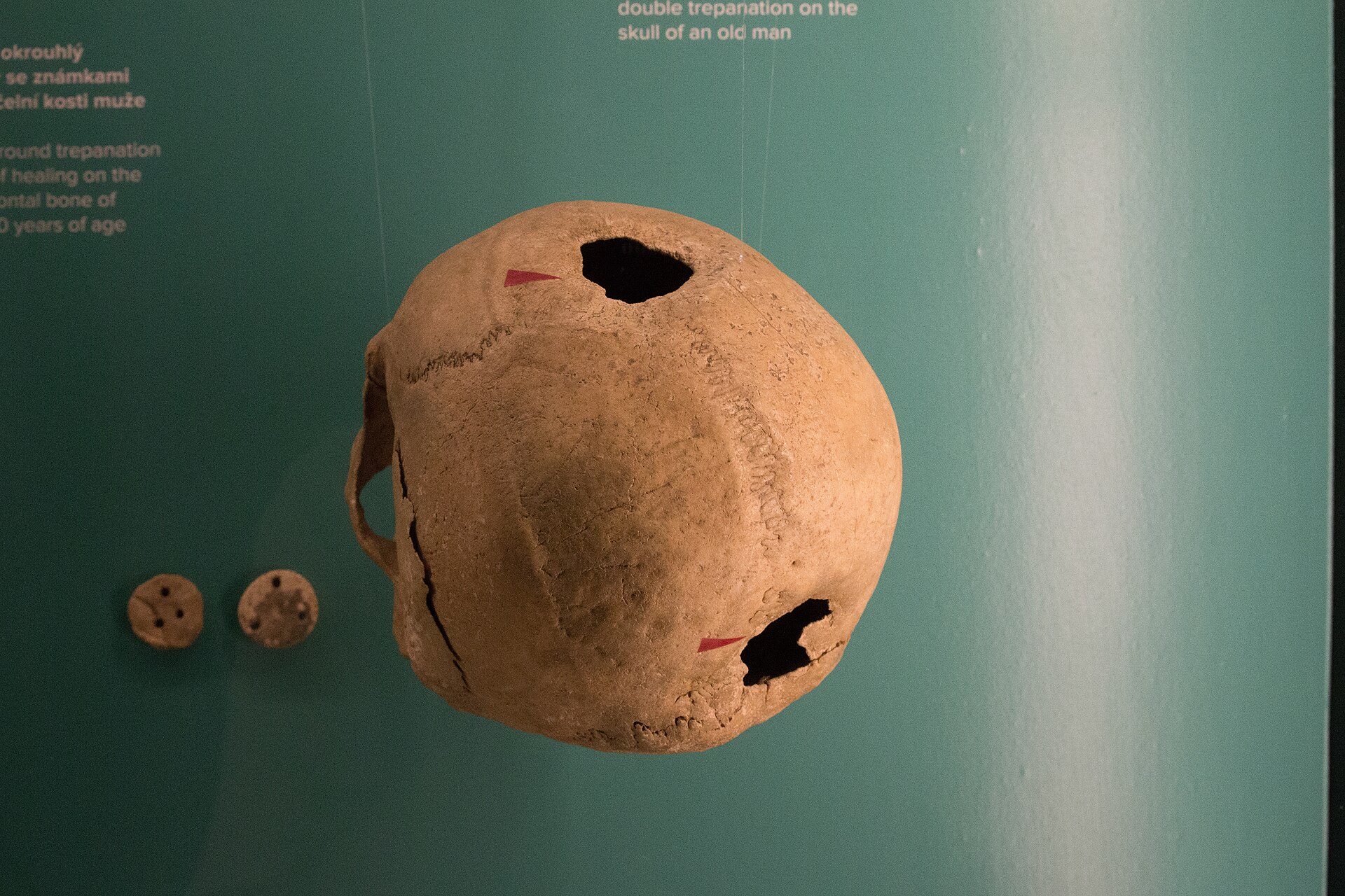 Ancient skull with two surgical holes