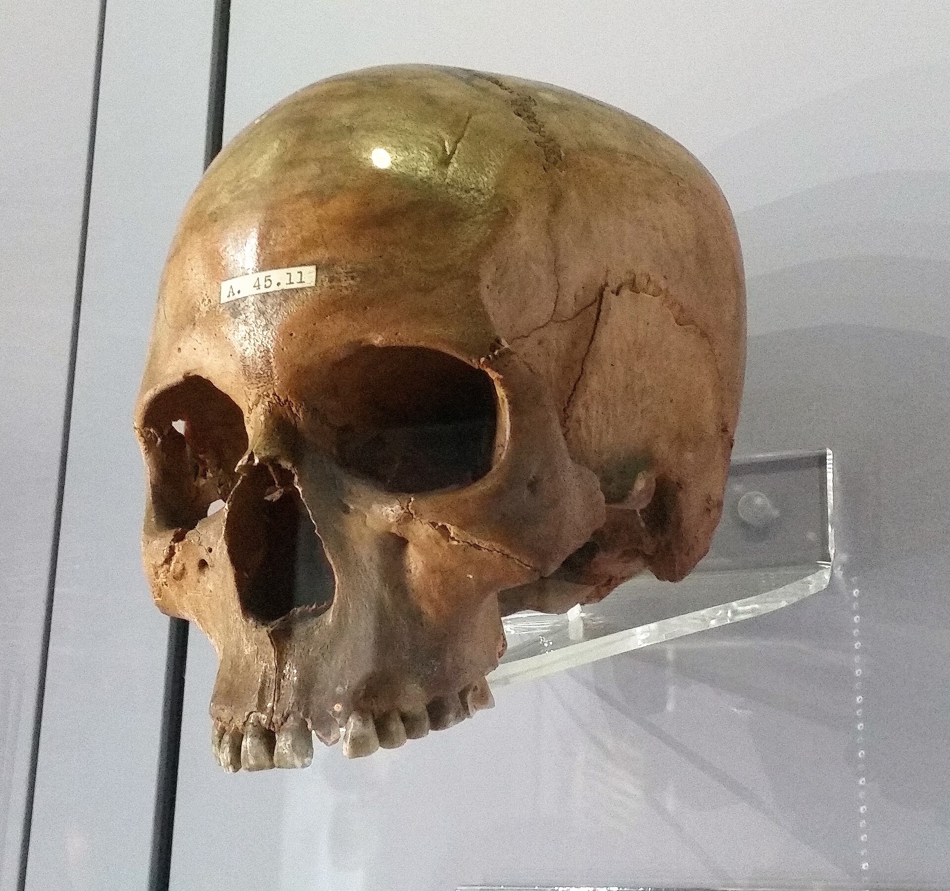 Cranium of an ancient Egyptian mummy